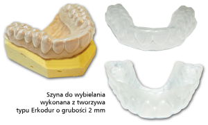 Wybielanie zębów metodą nakładkową