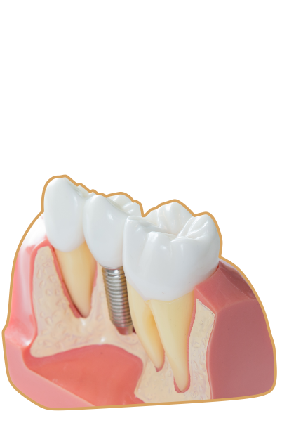 Dentysta Tarnowskie Góry